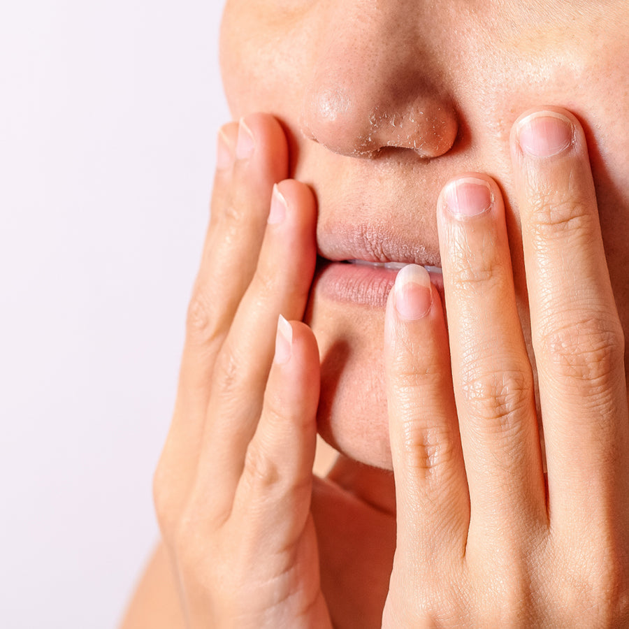 Home Remedies For Dry And Chapped Lips