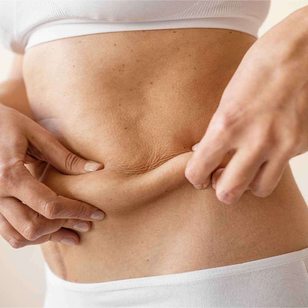 13 Effective Ways to Lose Belly Fat