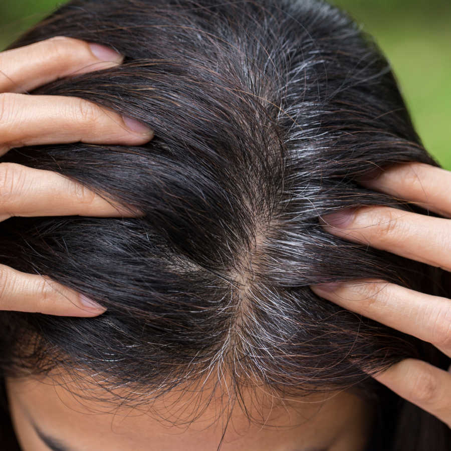 Home Remedies For Preventing Grey Hair In Young