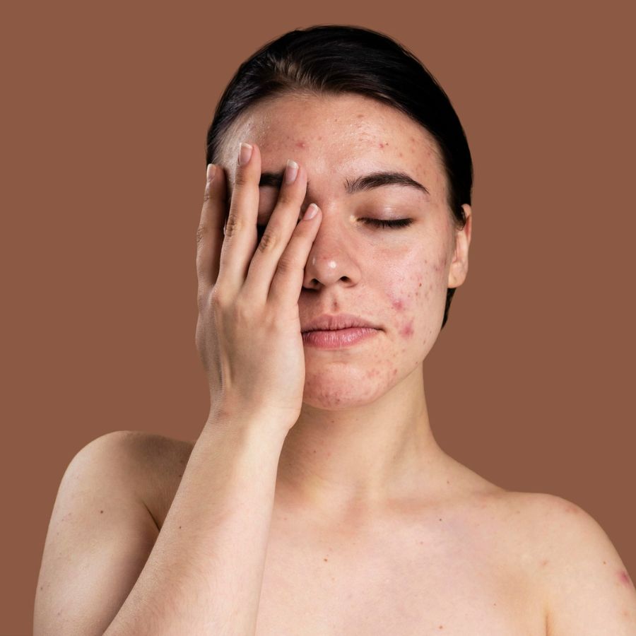 The Hidden Reasons For Your Skin Damage