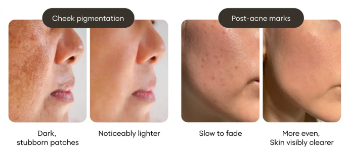 Spots faded faster than expected.